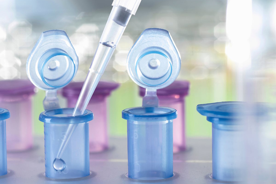 Bone Health Test