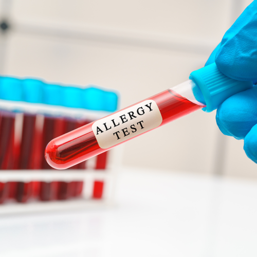 News • Functional Medical Diagnostic Laboratory NJ Allergy