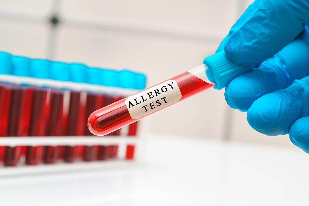 Allergy Tests - NOVALAB CORP NJ Reference Medical Diagnostic Laboratory