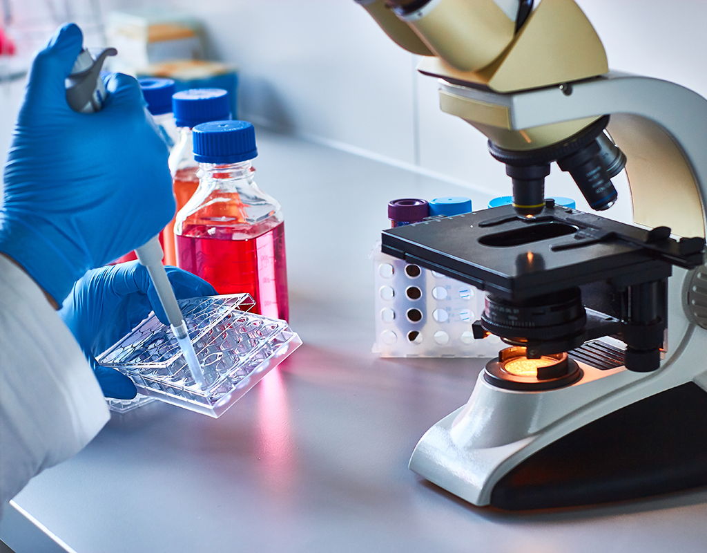 Hormone Imbalance Test