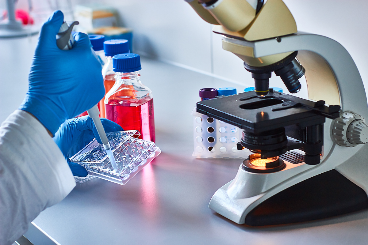 Hormone Imbalance Test