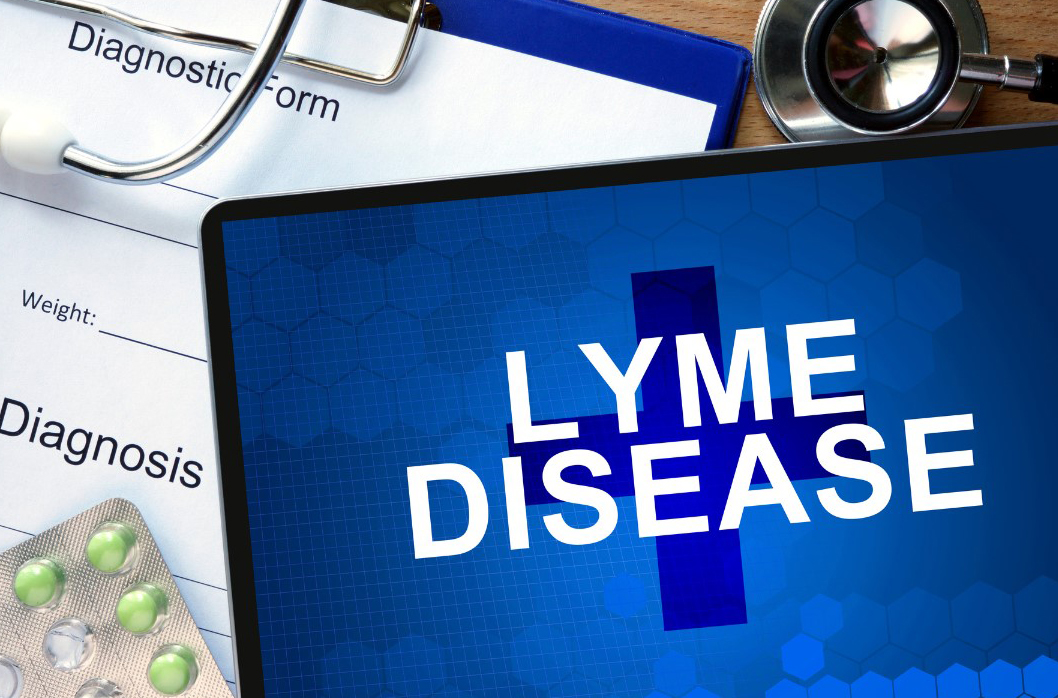 Lyme Disease Testing offered at Novalab, NJ