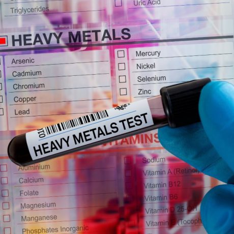 Heavy Metals Test